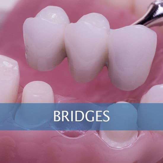 Bridges Services at Unique Dental of Framingham