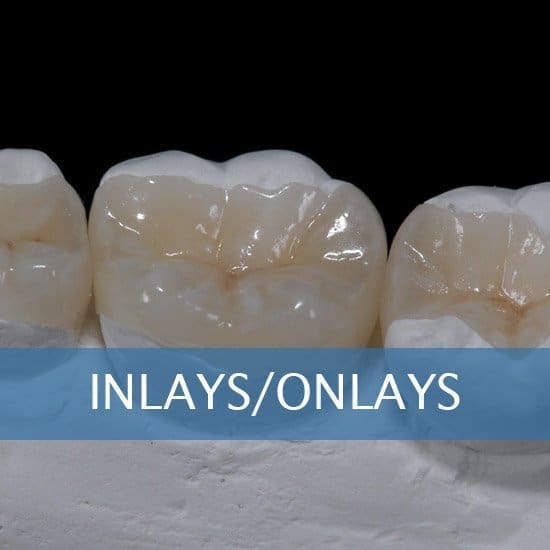 Inlays and onlays services at Unique Dental of Framingham.